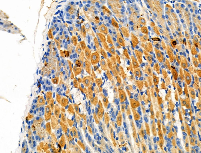 GSTT1 Antibody in Immunohistochemistry (Paraffin) (IHC (P))