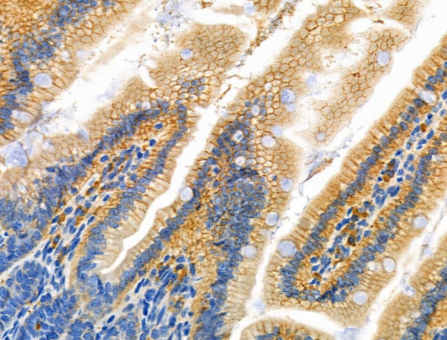 GSTT1 Antibody in Immunohistochemistry (Paraffin) (IHC (P))