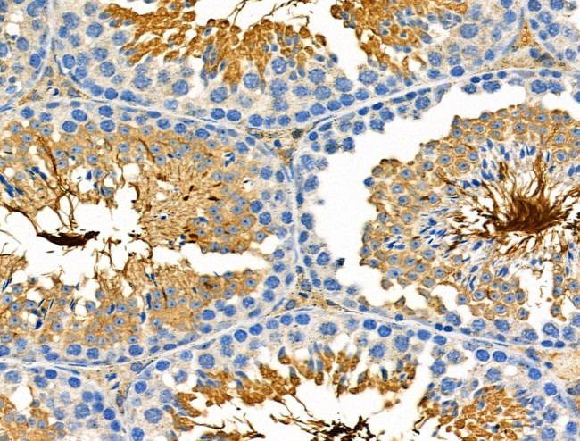 GSTT1 Antibody in Immunohistochemistry (Paraffin) (IHC (P))