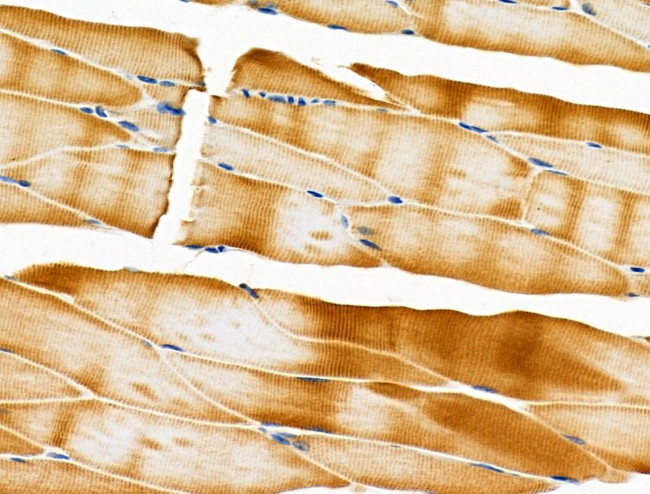 GSTT1 Antibody in Immunohistochemistry (Paraffin) (IHC (P))