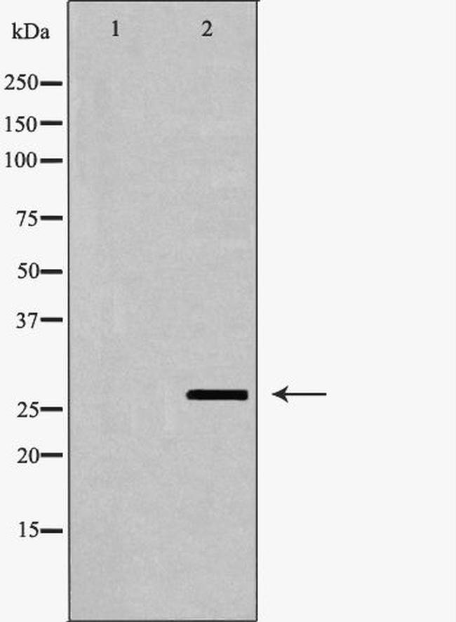 GSTT1 Antibody in Western Blot (WB)