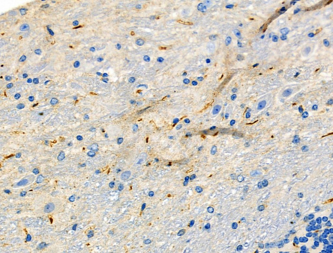 HAPLN1 Antibody in Immunohistochemistry (Paraffin) (IHC (P))