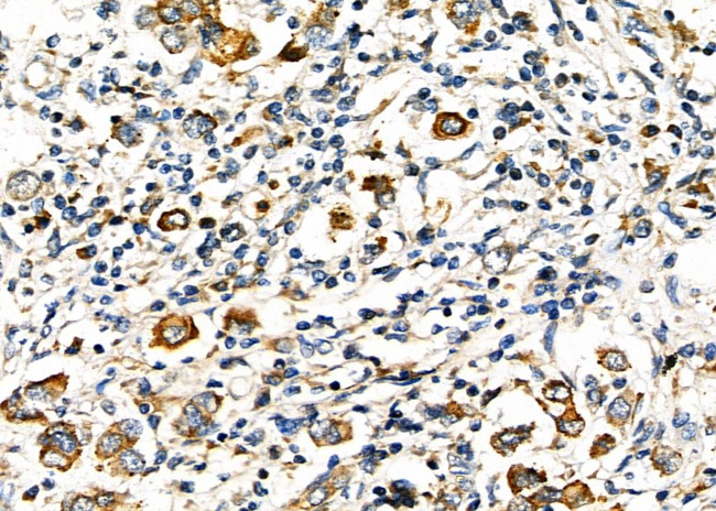 TIM-3 Antibody in Immunohistochemistry (Paraffin) (IHC (P))