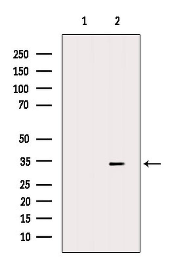 TIM-3 Antibody in Western Blot (WB)