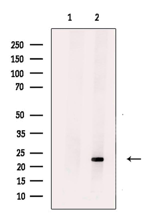 HBEGF Antibody in Western Blot (WB)