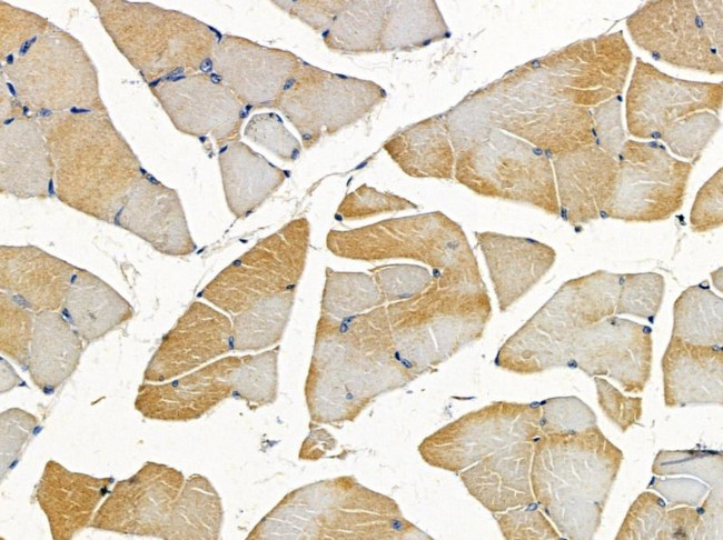 HBZ Antibody in Immunohistochemistry (Paraffin) (IHC (P))