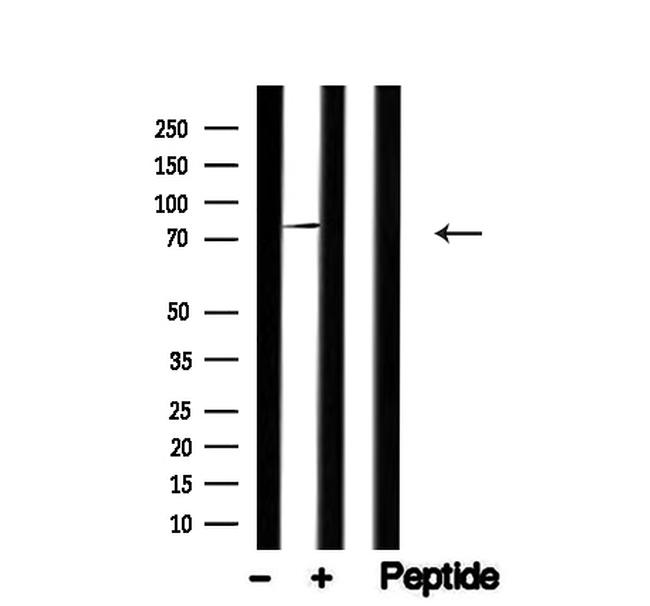 HCLS1 Antibody in Western Blot (WB)