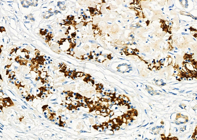 HGF Antibody in Immunohistochemistry (Paraffin) (IHC (P))