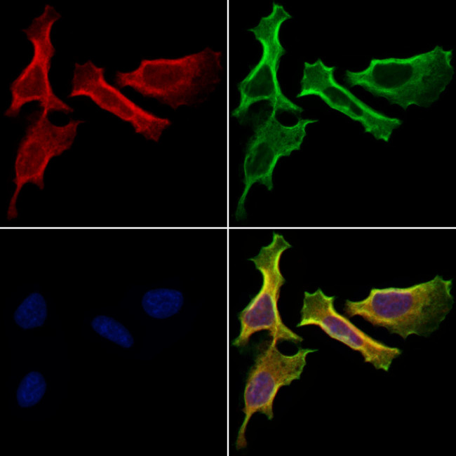 HHIP Antibody in Immunocytochemistry (ICC/IF)