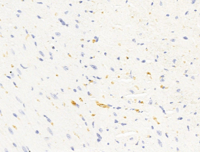 HHIP Antibody in Immunohistochemistry (Paraffin) (IHC (P))