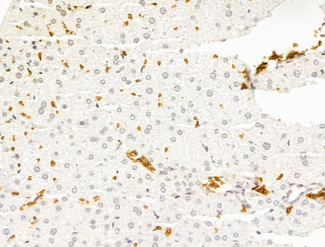 HHIP Antibody in Immunohistochemistry (Paraffin) (IHC (P))