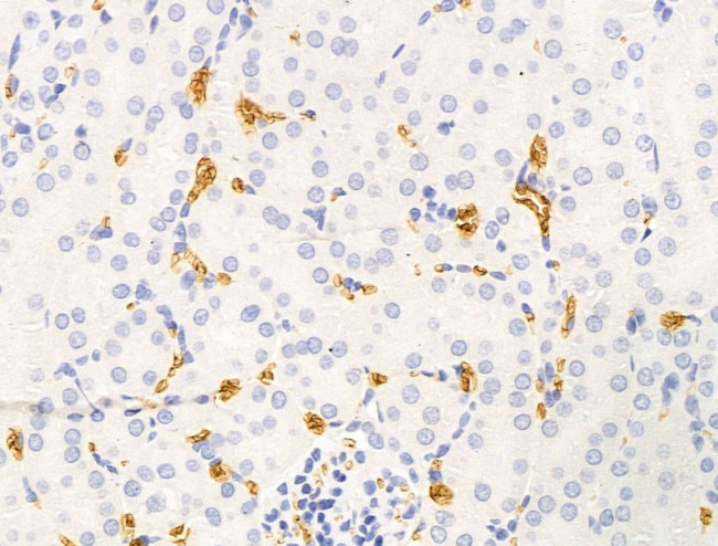 HHIP Antibody in Immunohistochemistry (Paraffin) (IHC (P))