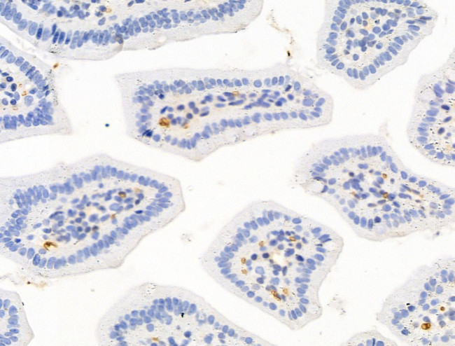 HHIP Antibody in Immunohistochemistry (Paraffin) (IHC (P))