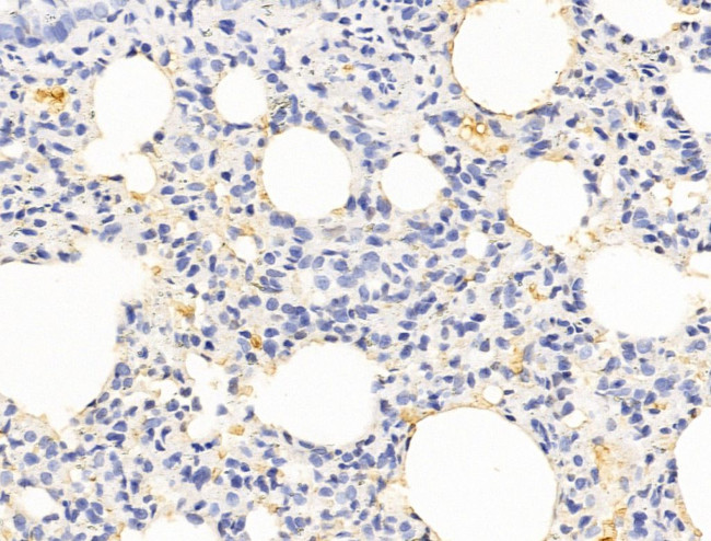 HHIP Antibody in Immunohistochemistry (Paraffin) (IHC (P))