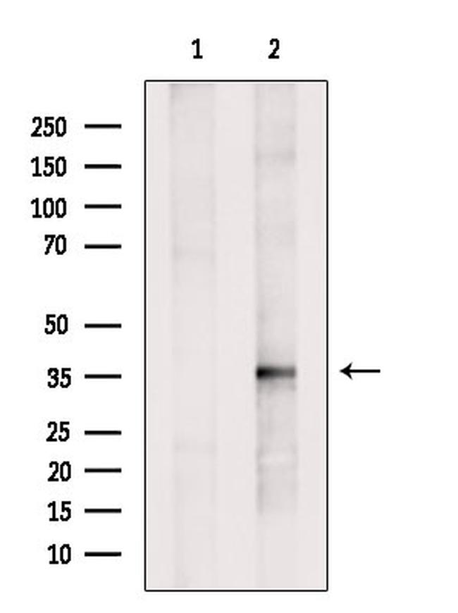 HIBADH Antibody in Western Blot (WB)