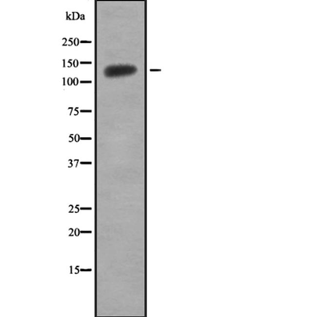 HIPK1 Antibody in Western Blot (WB)