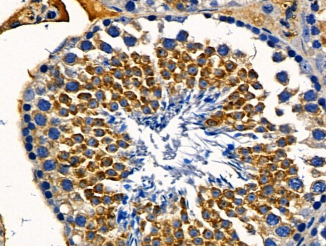 HLA-ABC Antibody in Immunohistochemistry (Paraffin) (IHC (P))