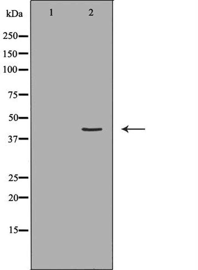 HLA-ABC Antibody in Western Blot (WB)