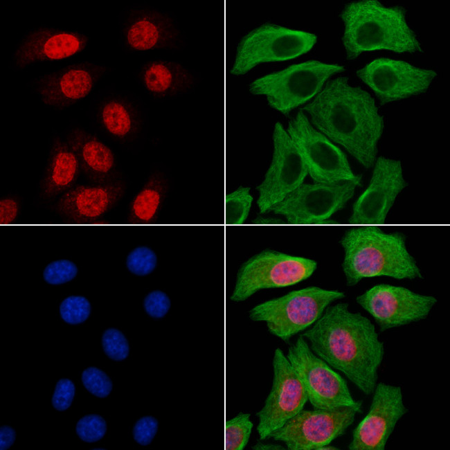 HMBOX1 Antibody in Immunocytochemistry (ICC/IF)