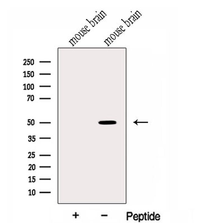 HMBOX1 Antibody in Western Blot (WB)