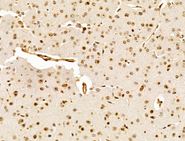 HMGA1 Antibody in Immunohistochemistry (Paraffin) (IHC (P))