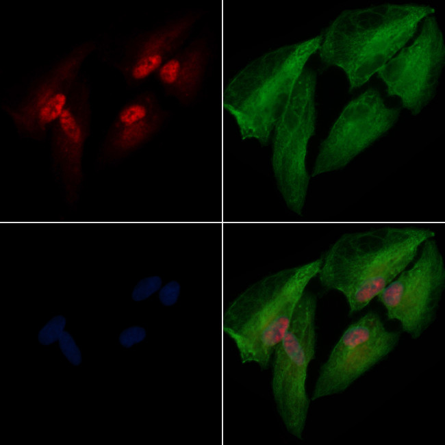 HMGB3 Antibody in Immunocytochemistry (ICC/IF)