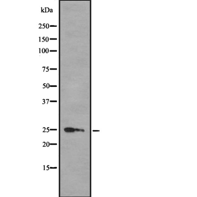 HMGB3 Antibody in Western Blot (WB)