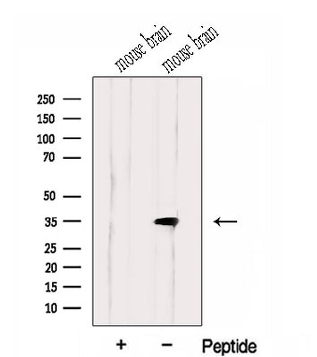 HMGCL Antibody in Western Blot (WB)