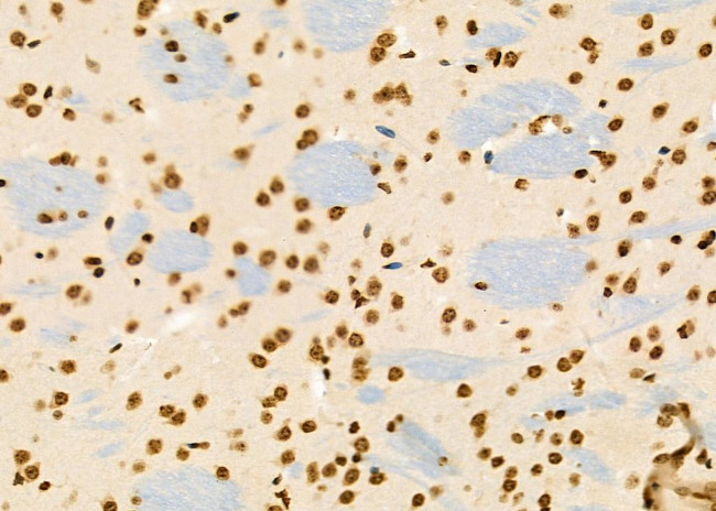 PCBP1 Antibody in Immunohistochemistry (Paraffin) (IHC (P))