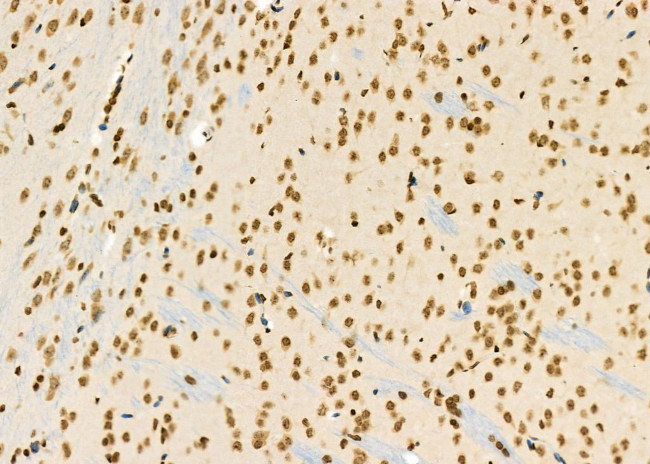 PCBP1 Antibody in Immunohistochemistry (Paraffin) (IHC (P))