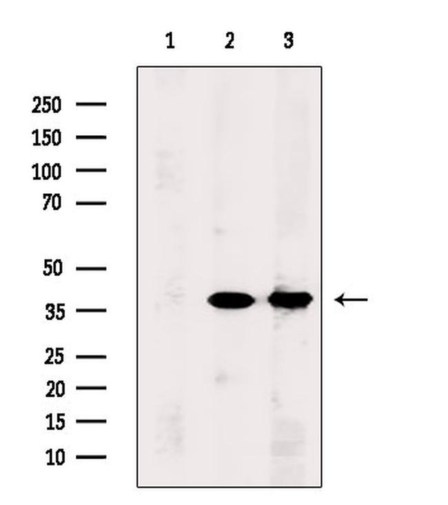 PCBP1 Antibody in Western Blot (WB)