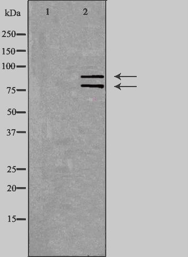 hnRNP M Antibody in Western Blot (WB)