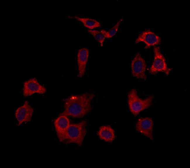 HOMER1 Antibody in Immunocytochemistry (ICC/IF)