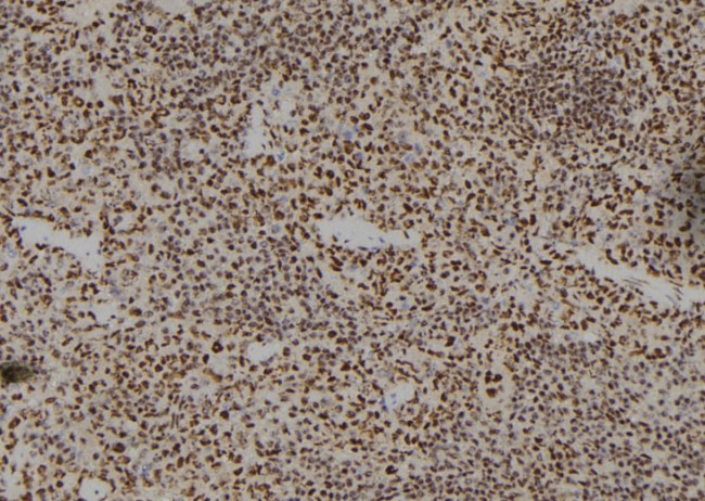 HOXA11 Antibody in Immunohistochemistry (Paraffin) (IHC (P))