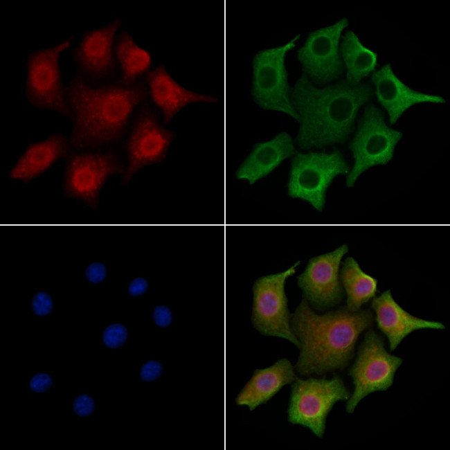 HP1 gamma Antibody in Immunocytochemistry (ICC/IF)