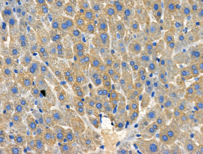 HSD11B1 Antibody in Immunohistochemistry (Paraffin) (IHC (P))