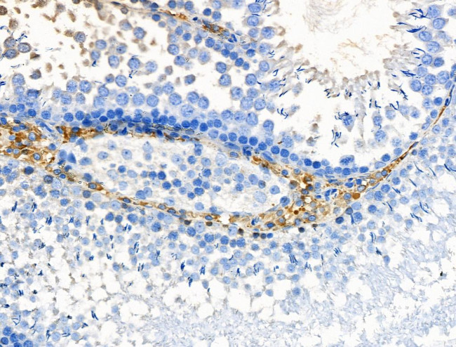 HSD11B1 Antibody in Immunohistochemistry (Paraffin) (IHC (P))