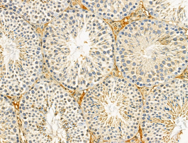 HtrA1 Antibody in Immunohistochemistry (Paraffin) (IHC (P))