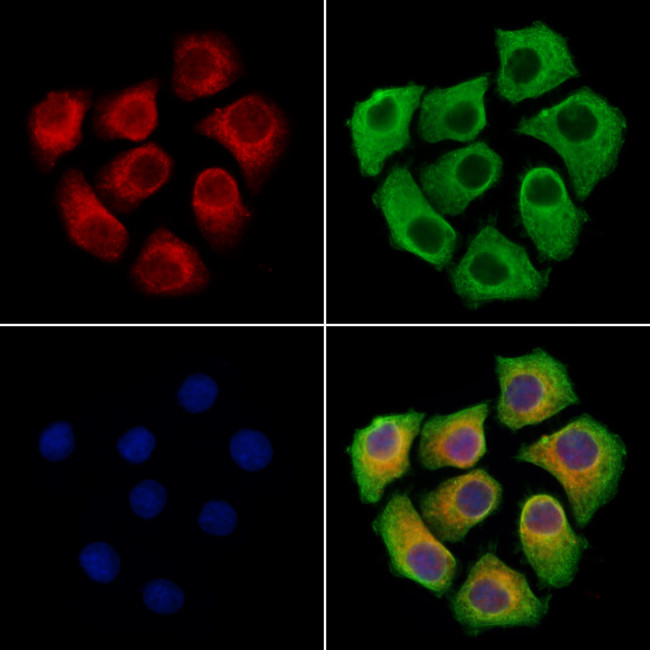 HAS2 Antibody in Immunocytochemistry (ICC/IF)