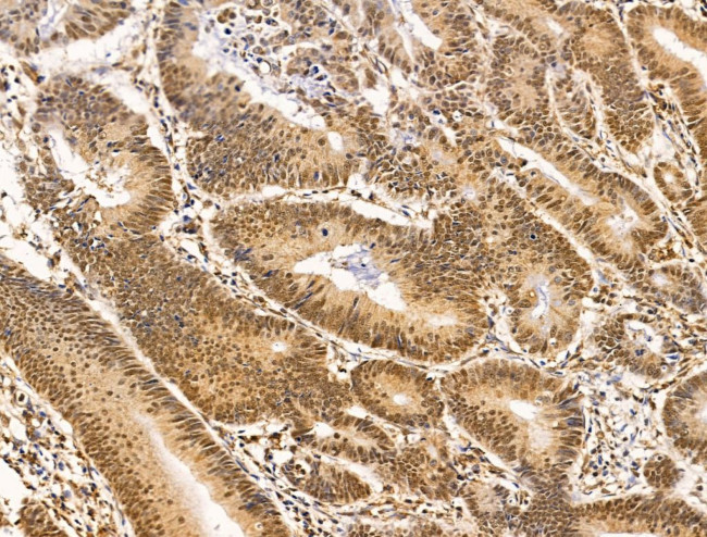 HAS2 Antibody in Immunohistochemistry (Paraffin) (IHC (P))