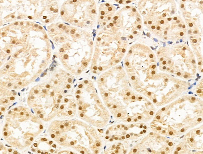 HAS2 Antibody in Immunohistochemistry (Paraffin) (IHC (P))