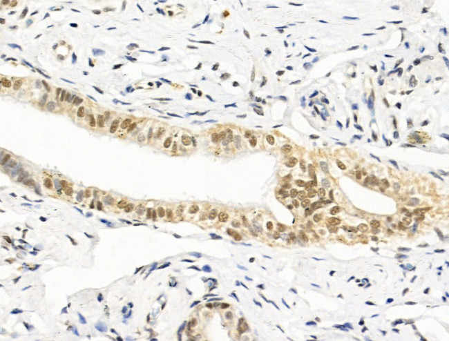 HAS2 Antibody in Immunohistochemistry (Paraffin) (IHC (P))