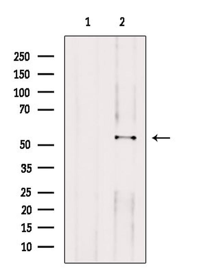 HAS2 Antibody in Western Blot (WB)