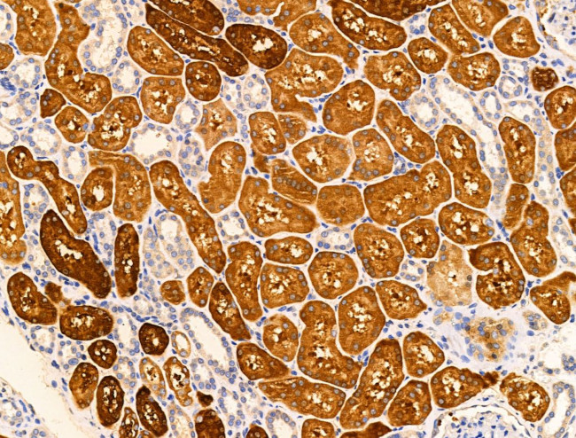 IEX-1 Antibody in Immunohistochemistry (Paraffin) (IHC (P))