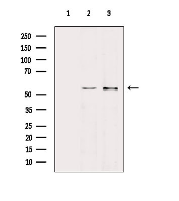 Human IgA Antibody in Western Blot (WB)