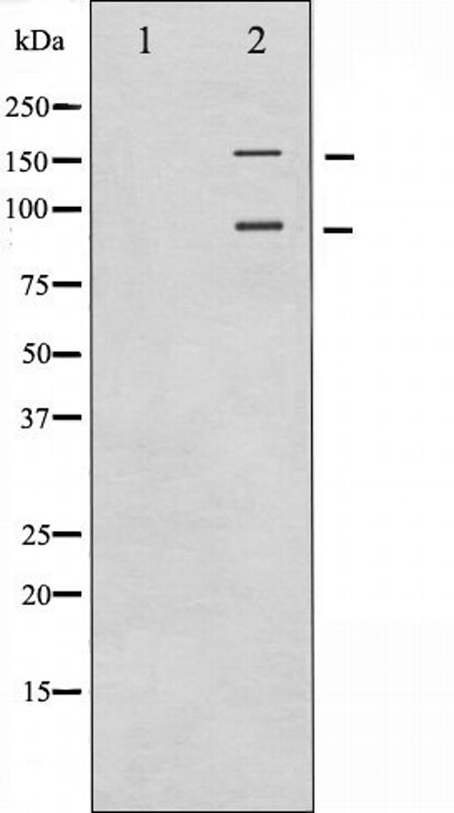 IGF1R alpha Antibody in Western Blot (WB)