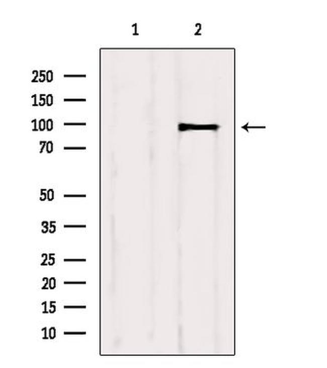 IGF1R alpha Antibody in Western Blot (WB)