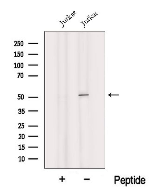 Heavy chain of IgG4 Antibody in Western Blot (WB)