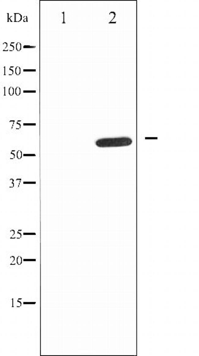 IL10RA Antibody in Western Blot (WB)