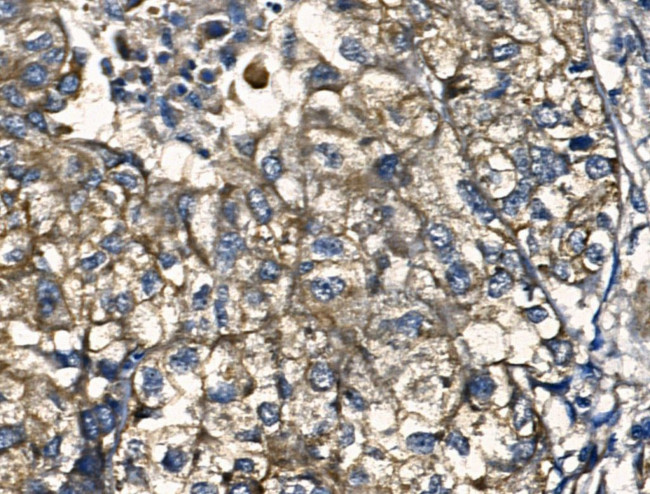 IL-12 p70 Antibody in Immunohistochemistry (Paraffin) (IHC (P))